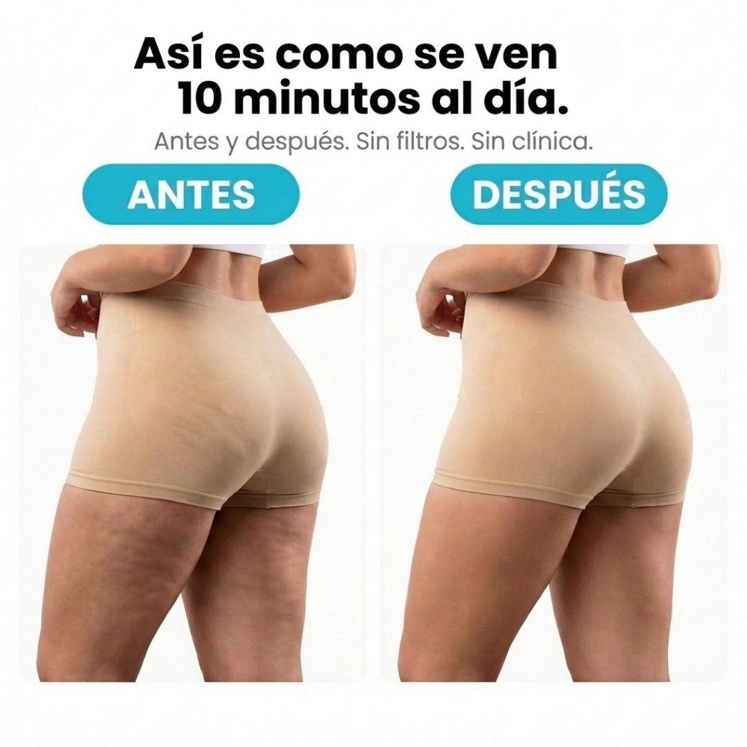 VELRA™ - Masajeador Rotatorio Anticelulitis