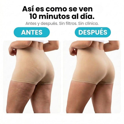 VELRA™ - Masajeador Rotatorio Anticelulitis